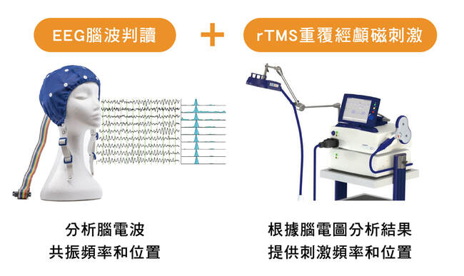 iTMS 個人化經顱磁刺激術